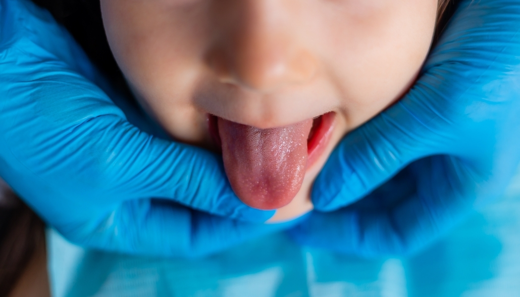 What Does Your Tongue Say About Your Health? What Do Its Color and Appearance Mean?